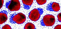 hybrid nanoparticles